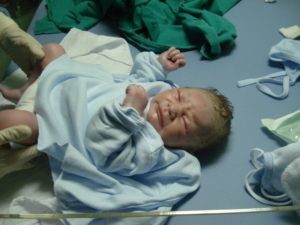 birth injury and cerebral palsy